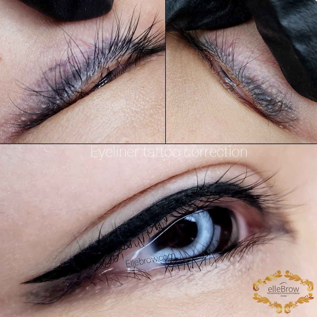 Permanent Eyeliner Tattoo Correction Before and After