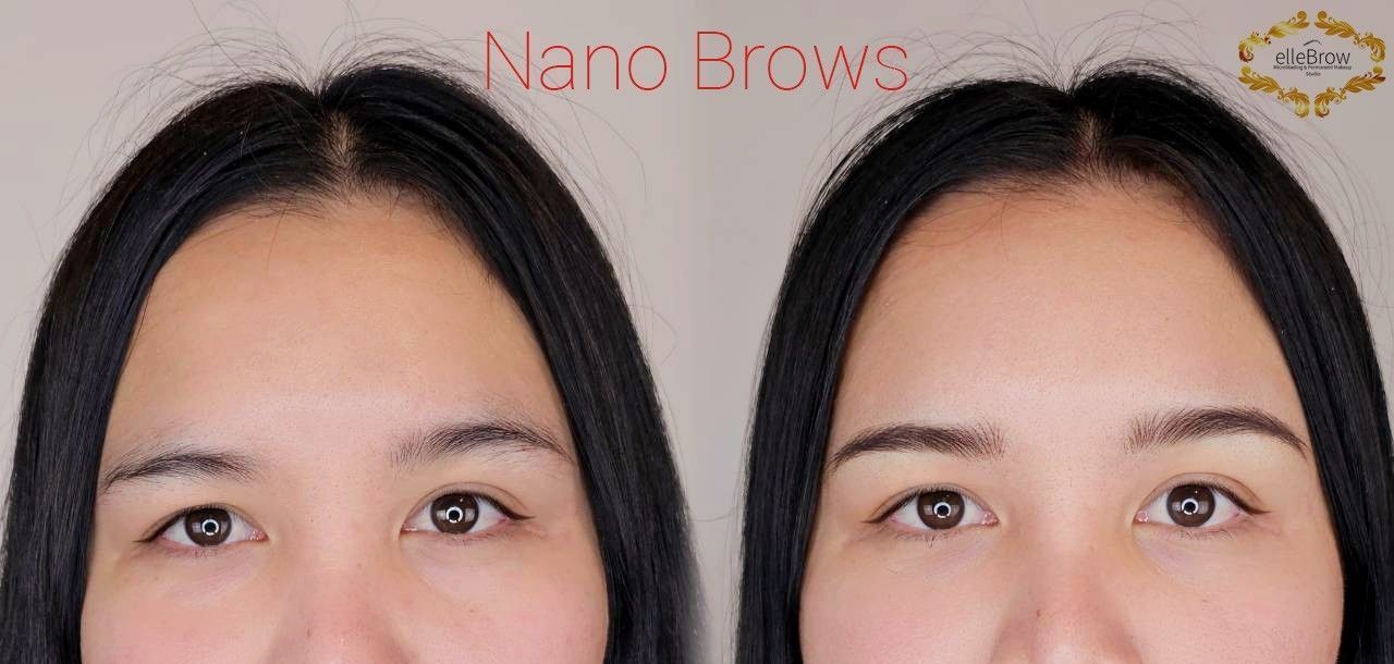 Woman with Uneven Eyebrows - Before and After Nano Brows