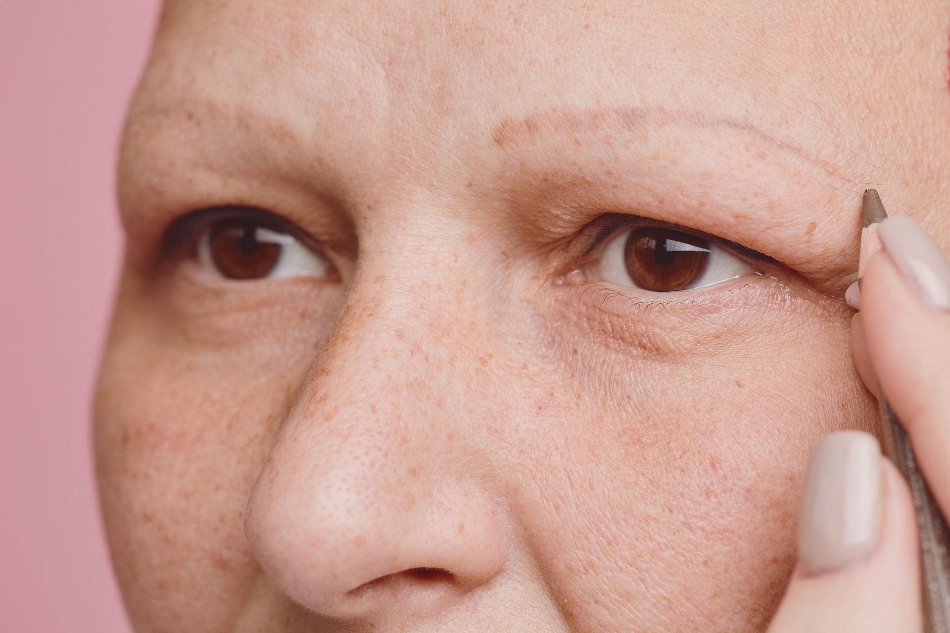 Woman with Alopecia, no eyebrows