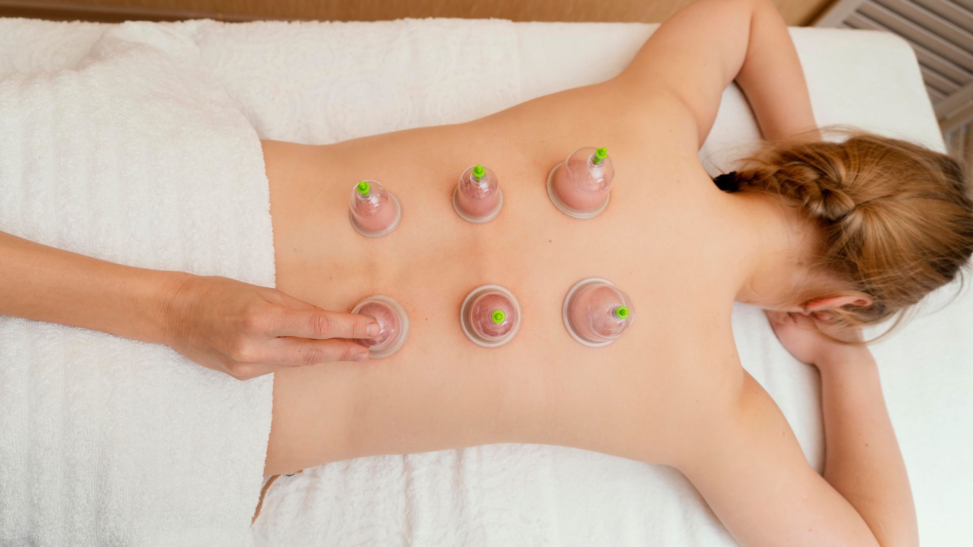 Person receiving cupping therapy on their back, six cups attached, white towel and table.