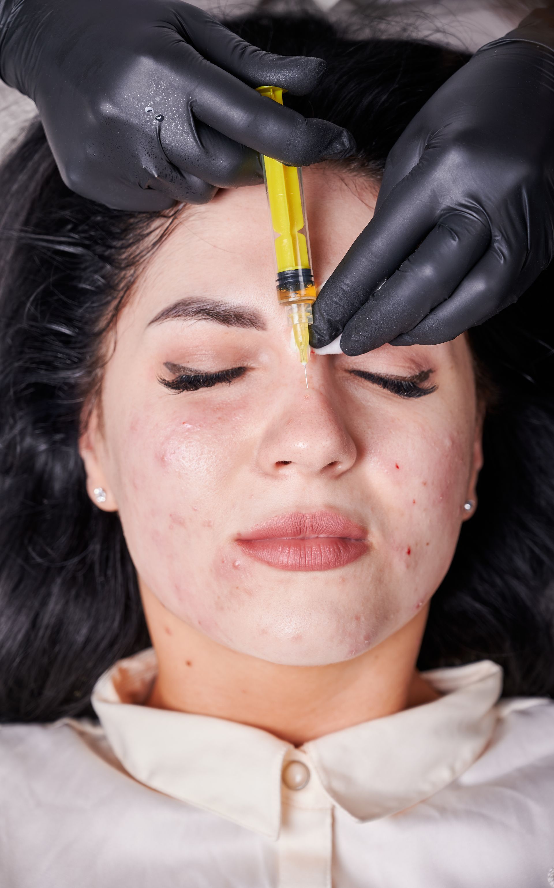 A woman is getting a botox injection in her forehead.