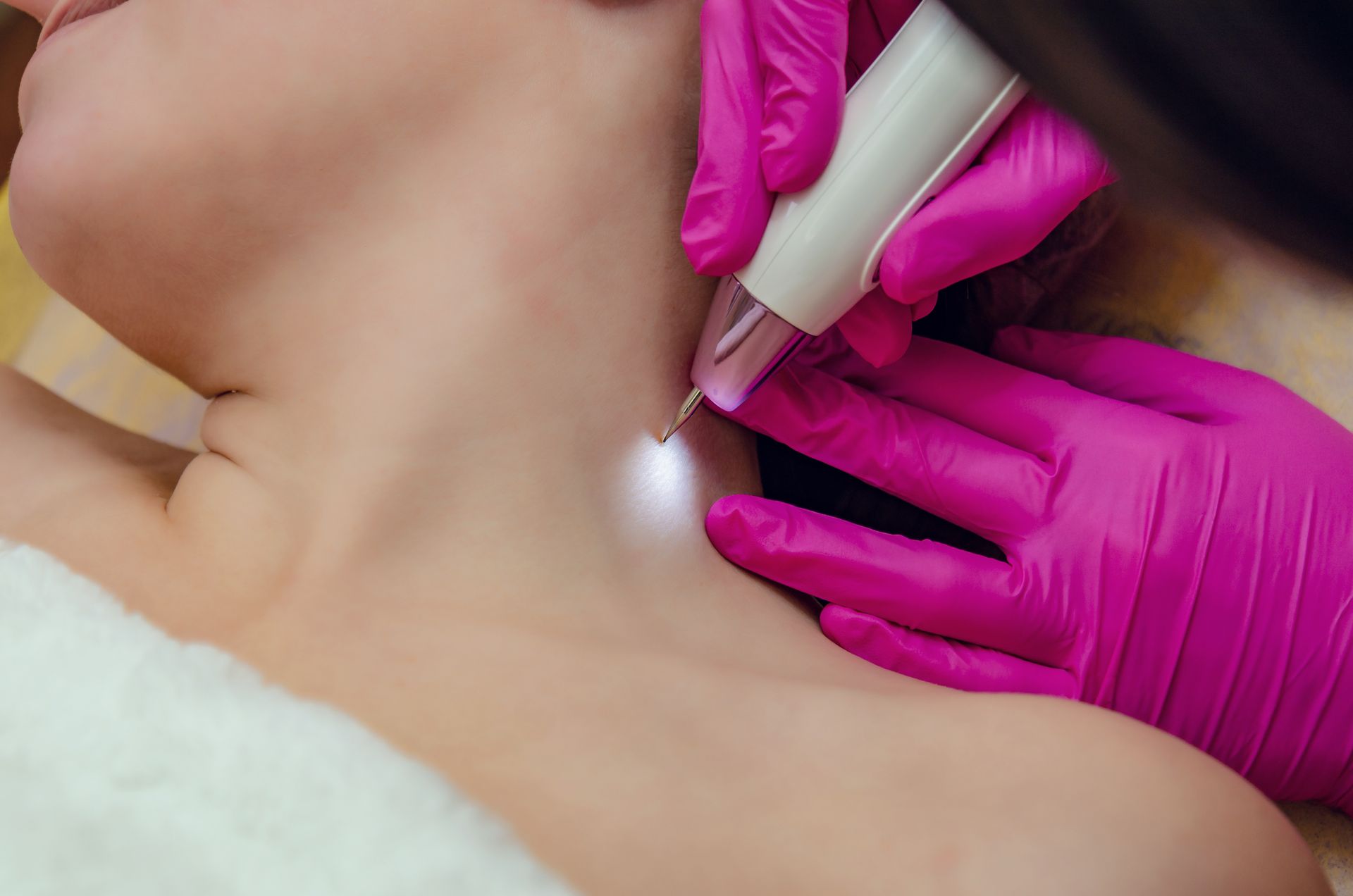 A woman is getting a laser treatment on her neck.