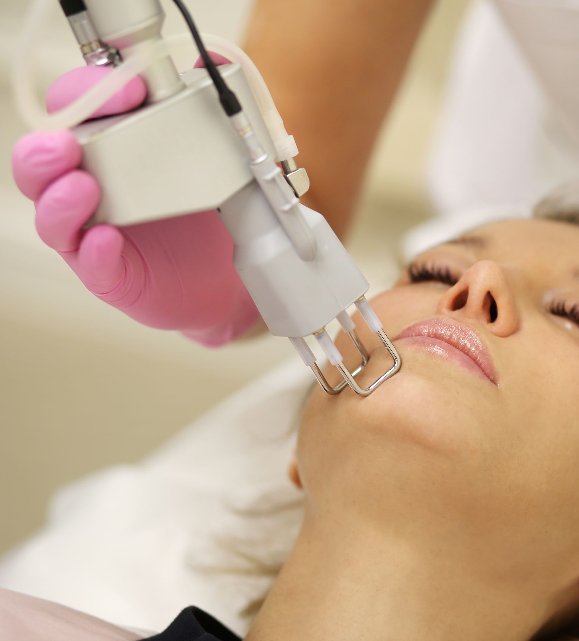 A woman is getting a laser treatment on her face