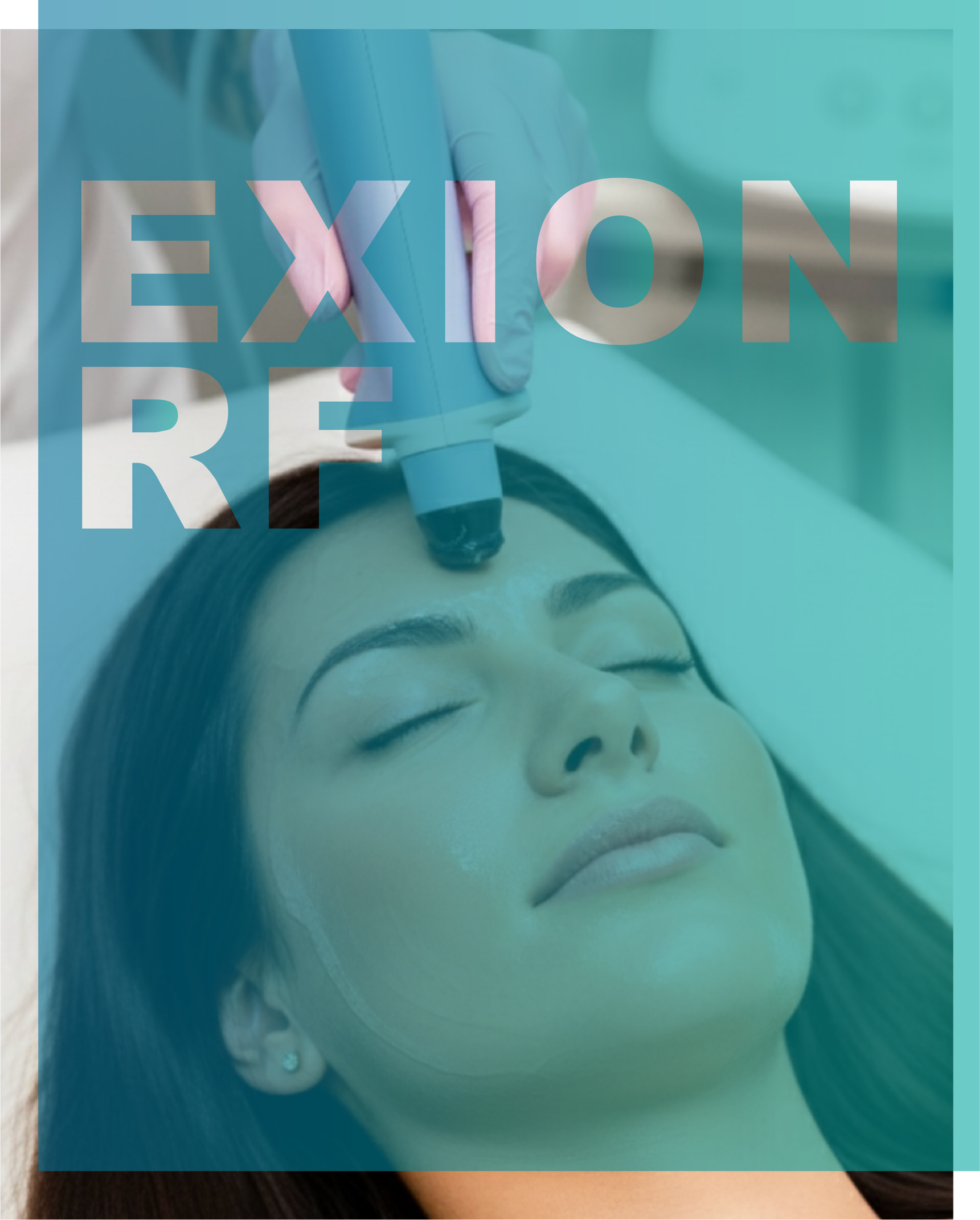 Microneedling in Michigan