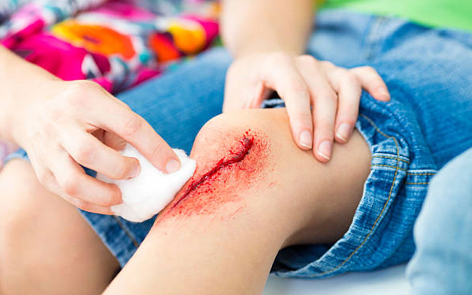Person tending to a child's scraped knee, cleaning the wound with a cotton ball.