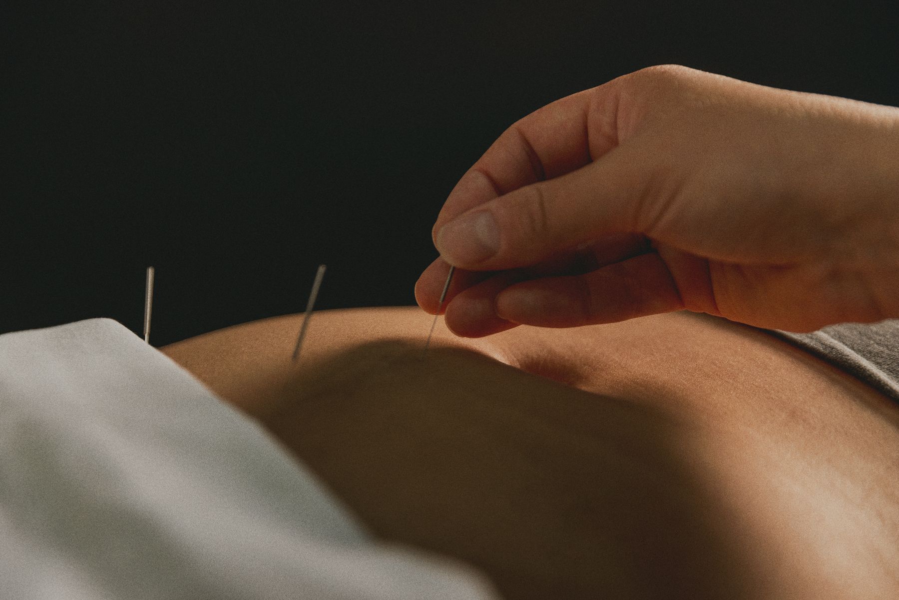 acupuncture santé féminine