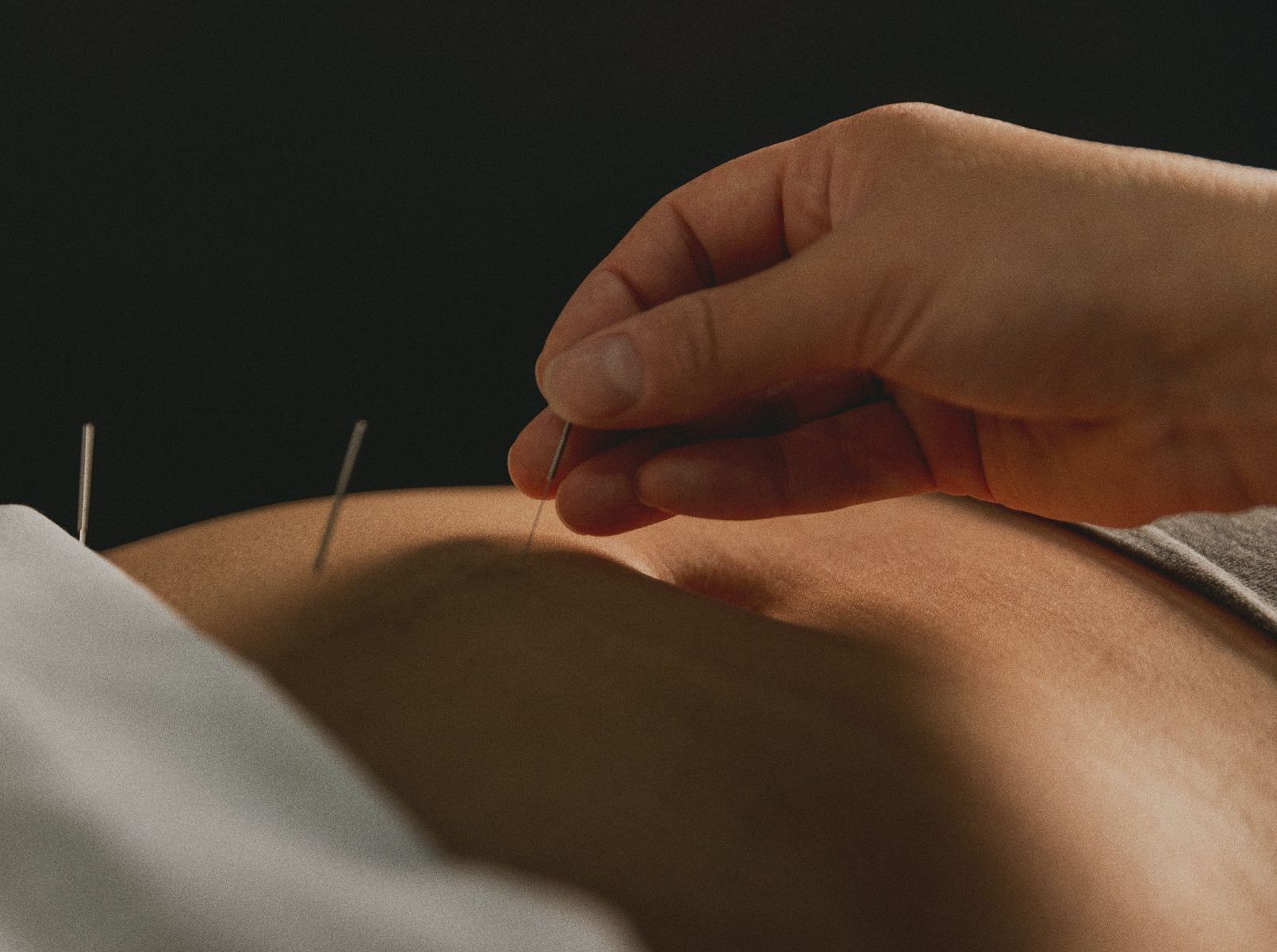 acupuncture santé féminine