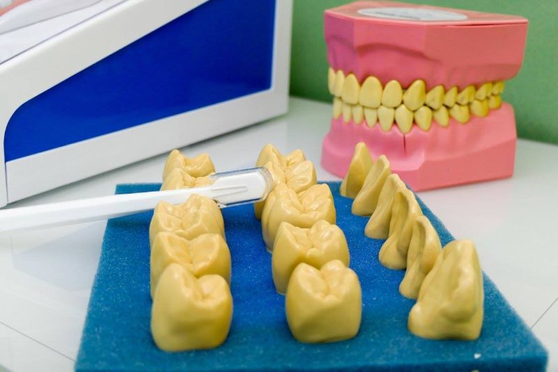 Sbiancamento dentale