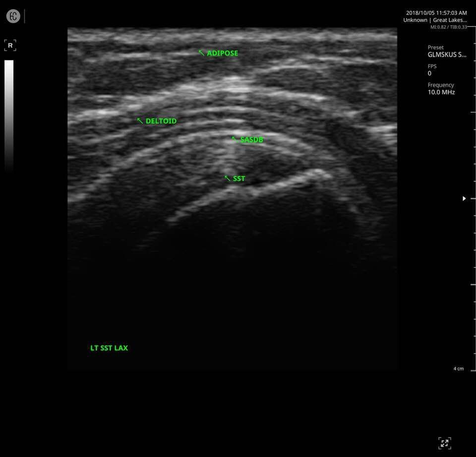 Different Findings in X-Ray Result