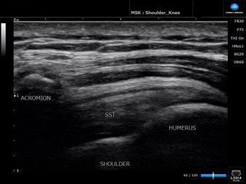 Ultrasound Findings