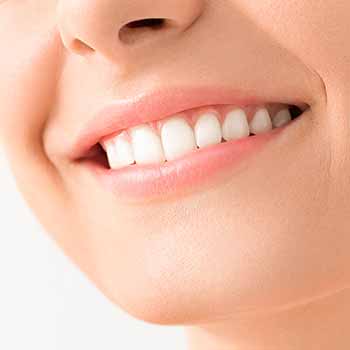 Beautiful smile - Teeth whitening in Durant, OK
