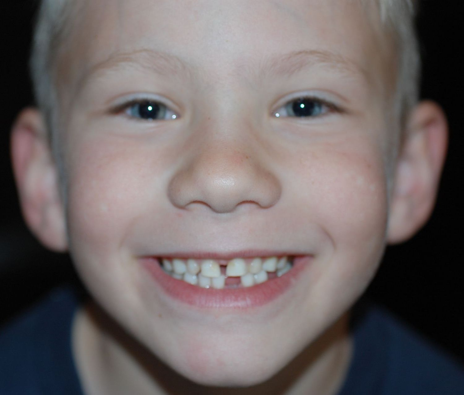 Young boy missing teeth