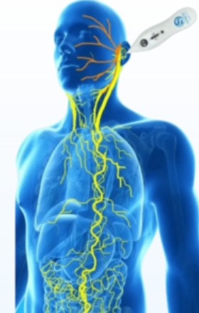 A stylized blue human figure shows a yellow nervous system path; a hand-held device stimulates the area behind the ear.