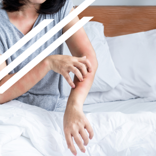 A woman is scratching her arm while sitting on a bed