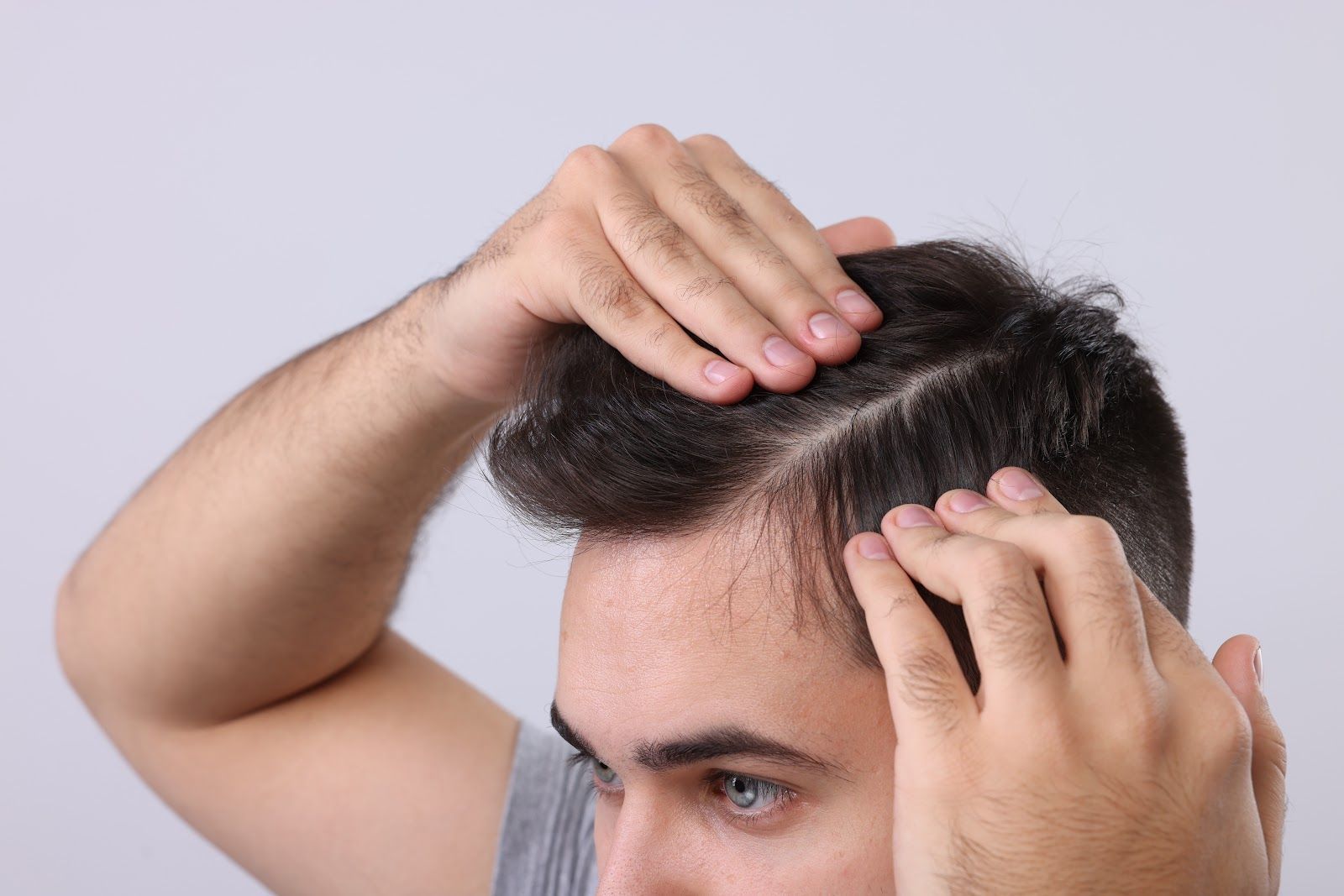 Man examining his thinning hairline with both hands, close-up.
