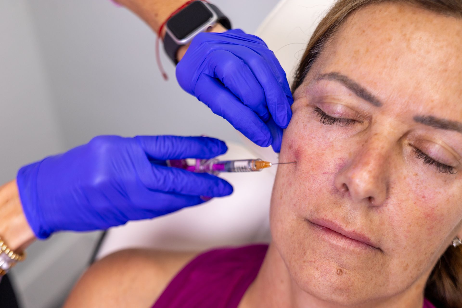 A woman is getting a botox injection in her face.