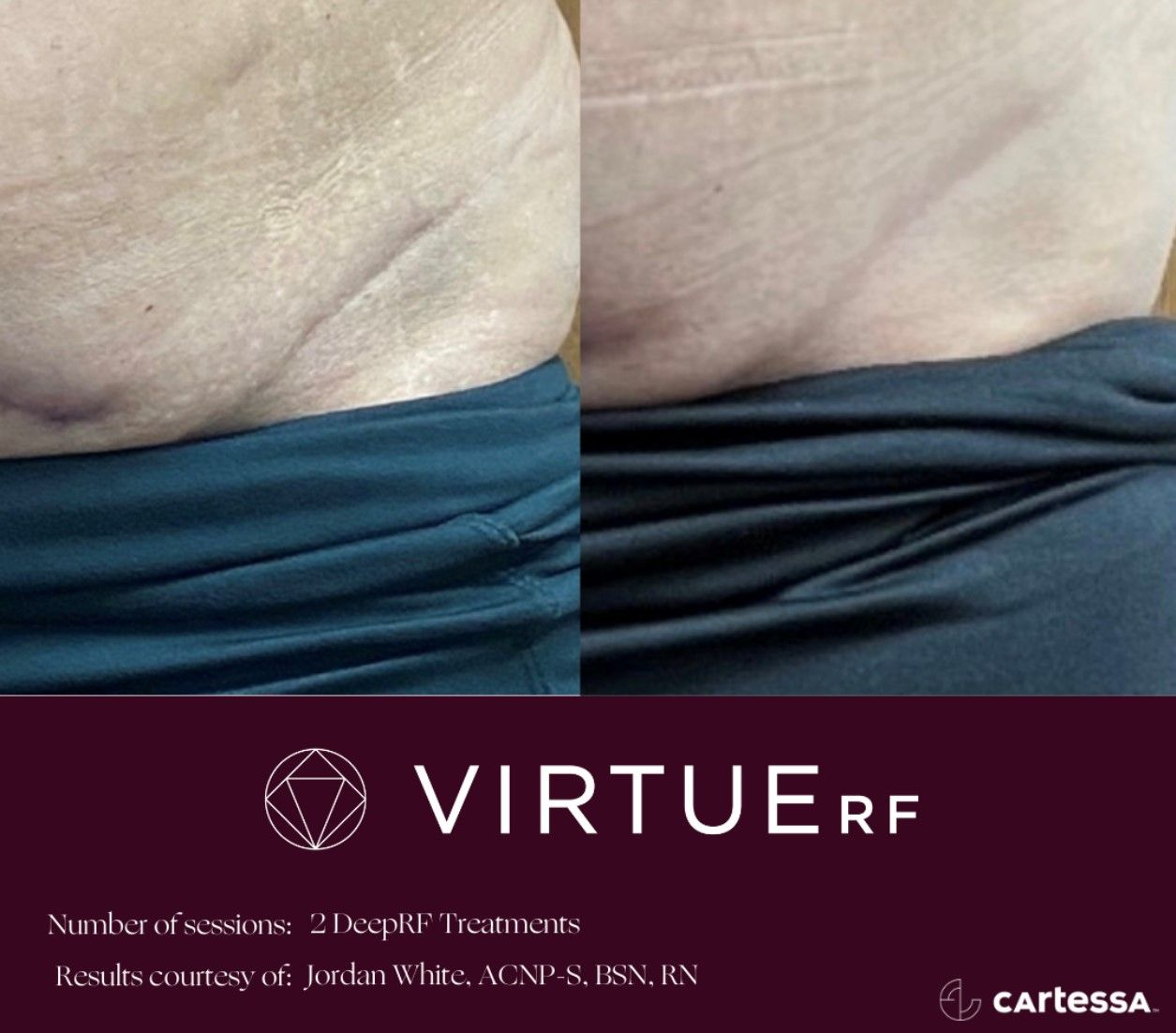 A woman is getting a facial treatment at a beauty salon.