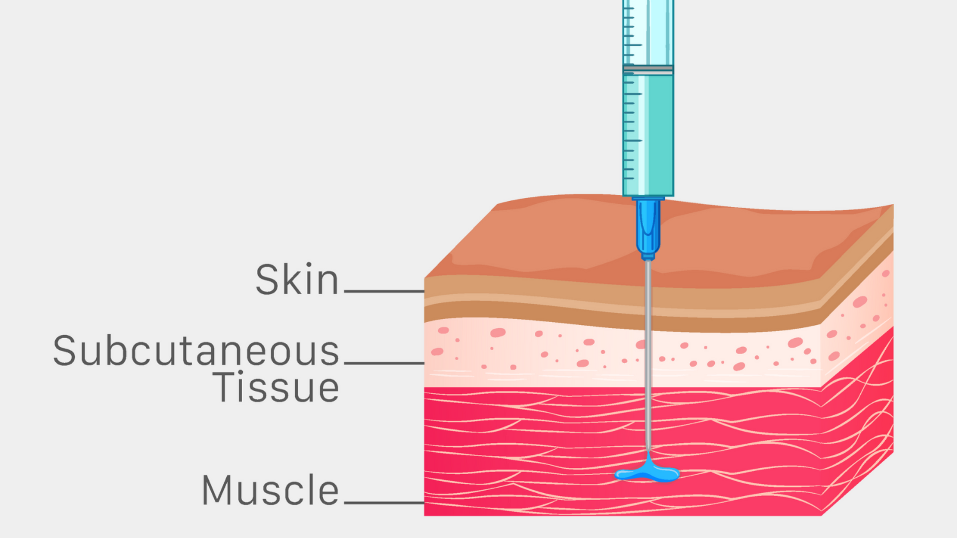 A woman is getting an injection in her arm.