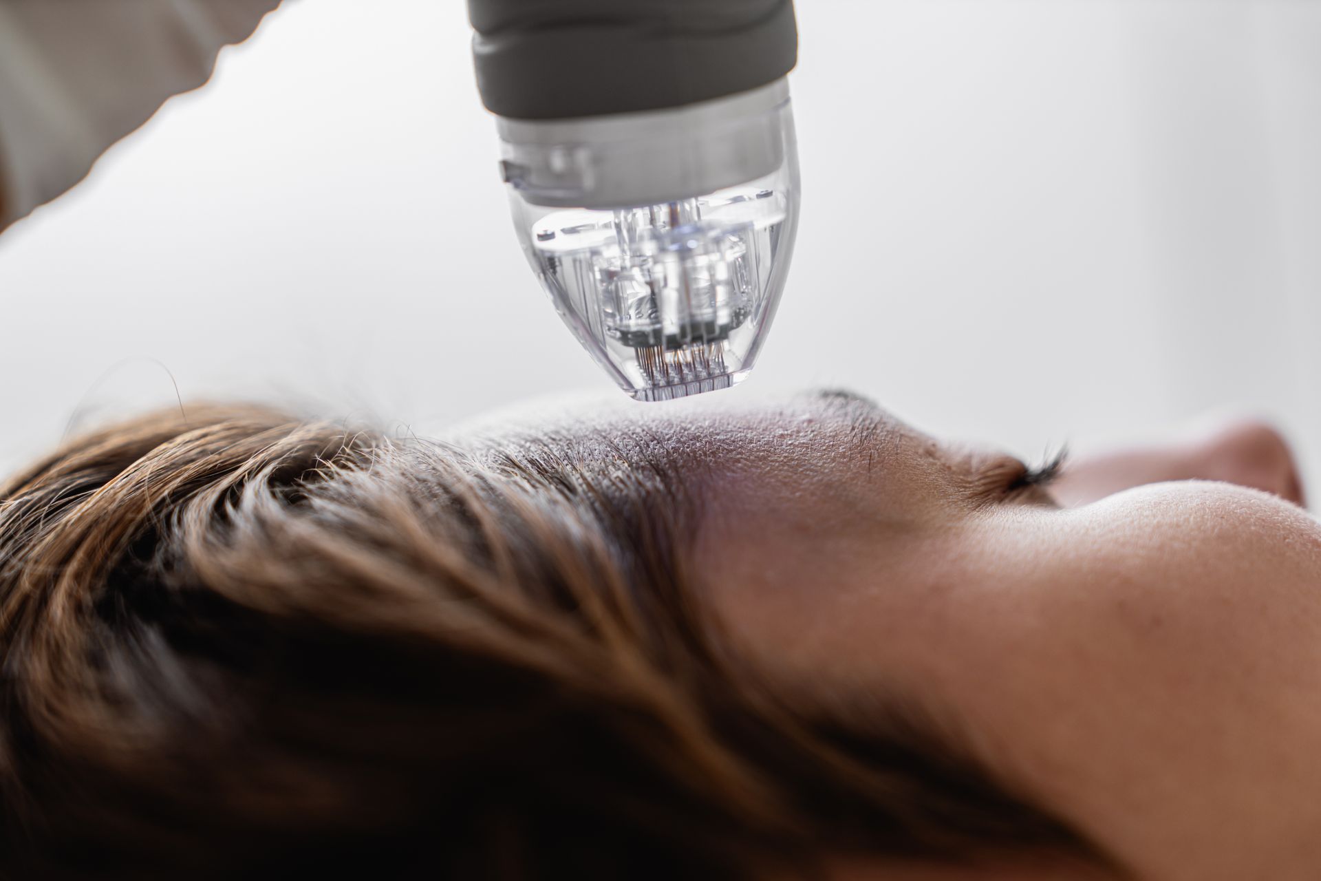 A woman is getting a laser treatment on her face.