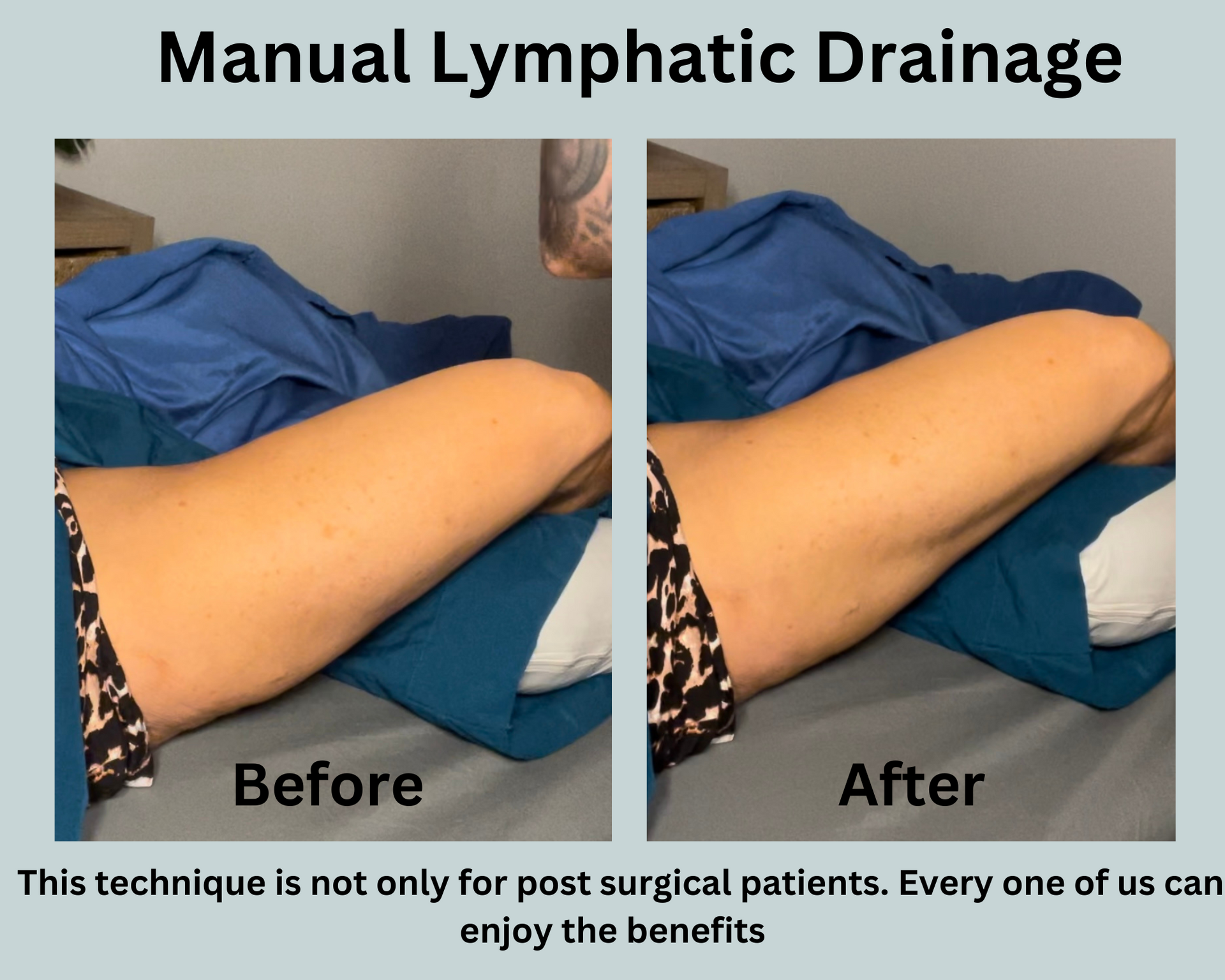 A before and after photo of a person getting a manual lymphatic drainage