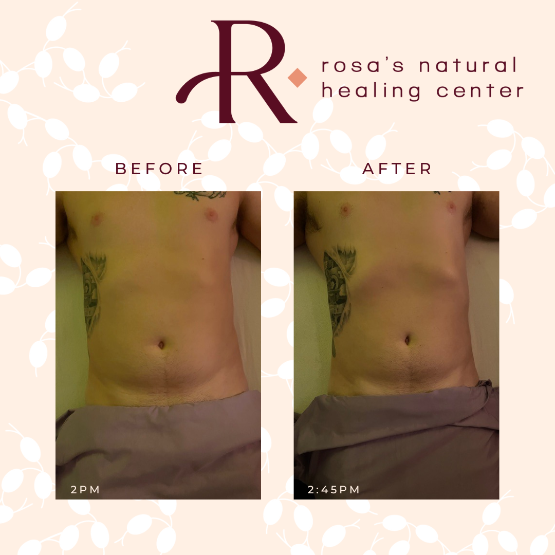 A before and after picture of a man 's stomach from rosa 's natural healing center