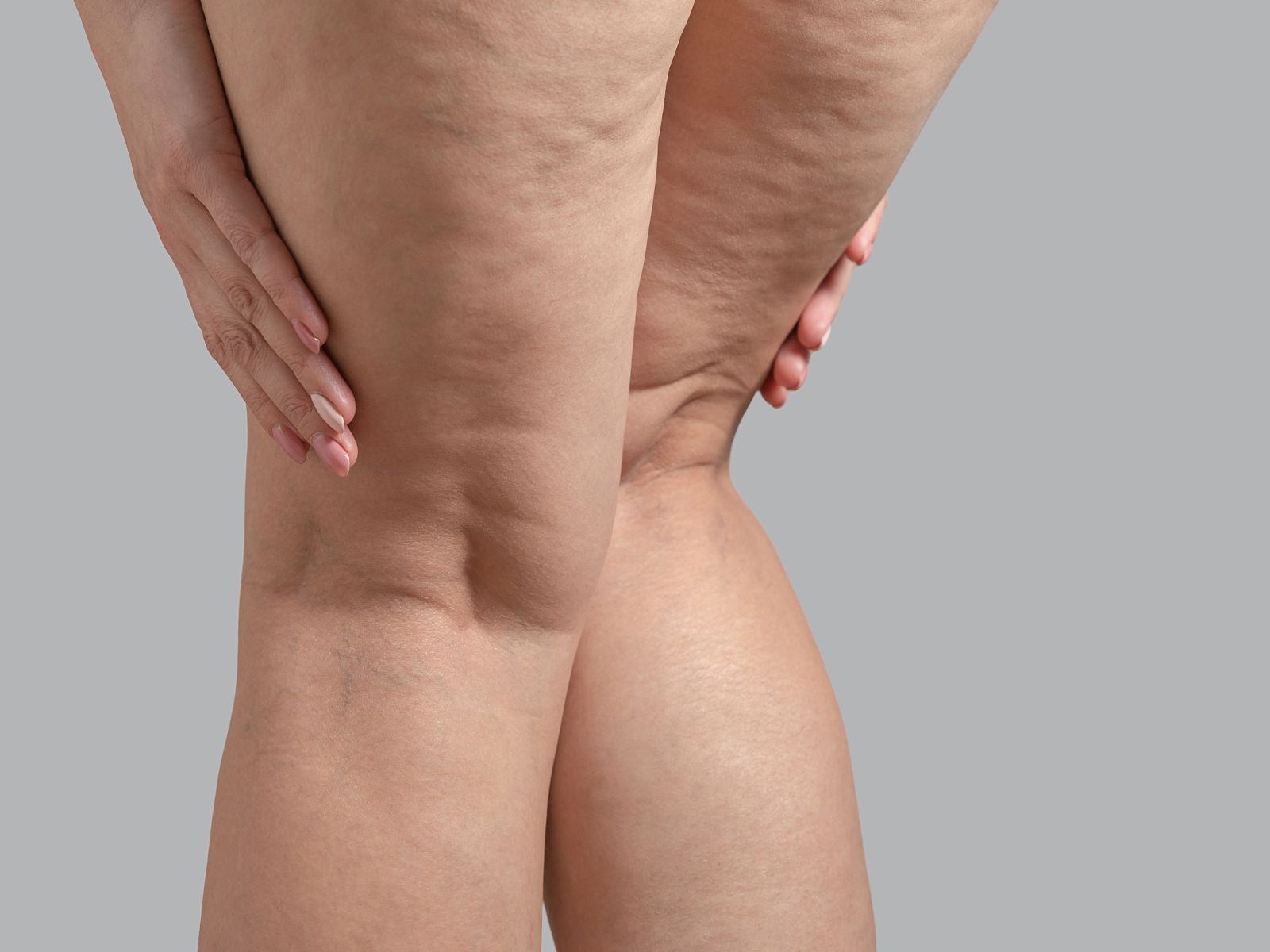 A woman is holding her knee in pain.