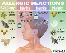 Symptoms - allergy in Framingham, MA