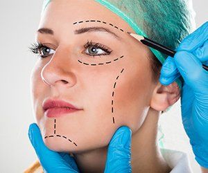 Plastic Surgeon — Patient With Guide Marks in Orlando, FL Plastic Surgeon — Patient With Guide Marks in Orlando, FL
