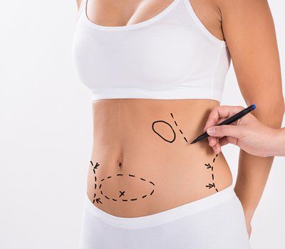 Dos and Don'ts for Tummy Tuck Surgery - Orlando FL - The Institute