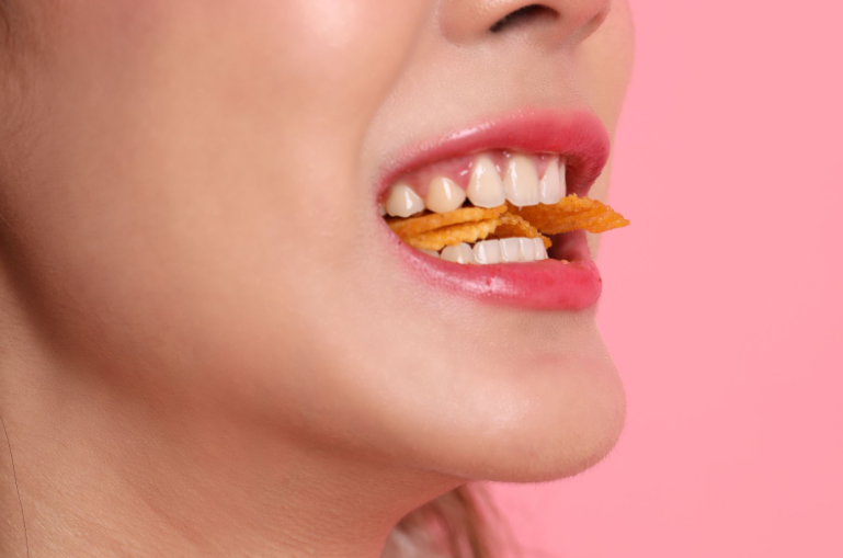 Sour Truths: How Acids in Your Diet Affect Your Teeth