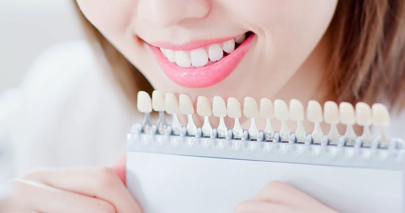 Navigating Tooth Color Choices for Dental Restorations