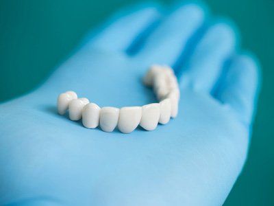 3 Facts about Dental Bridges You Should Know