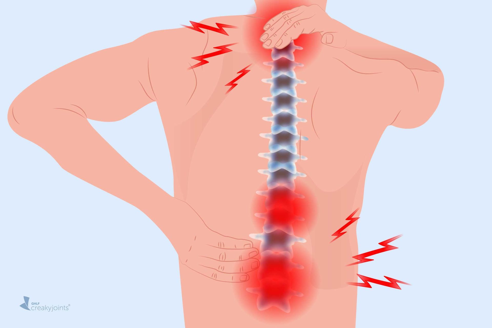 Diagnosing Spinal Issues