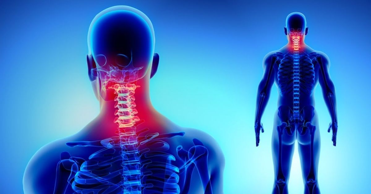 Diagnose Cranio-Cervical Instability