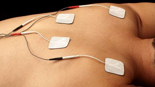 Electrotherapy muscle stimulation in Keizer Oregon.