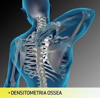figura della densitometria ossea
