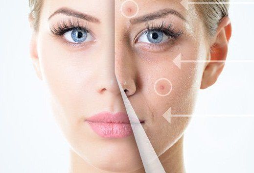 figura del trattamento dell'acne