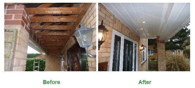 fascias before and after 1