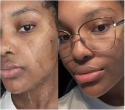 A before and after photo of a woman wearing glasses