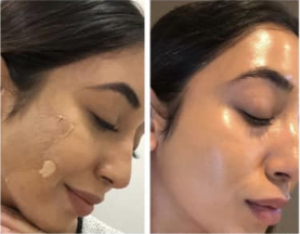 A before and after photo of a woman 's face