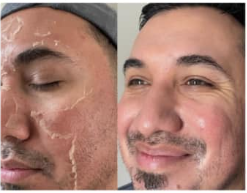 A man with a beard is washing his face and smiling.