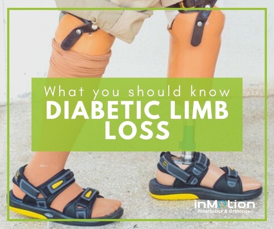 What You Should Know About Diabetic Limb Loss InMotion