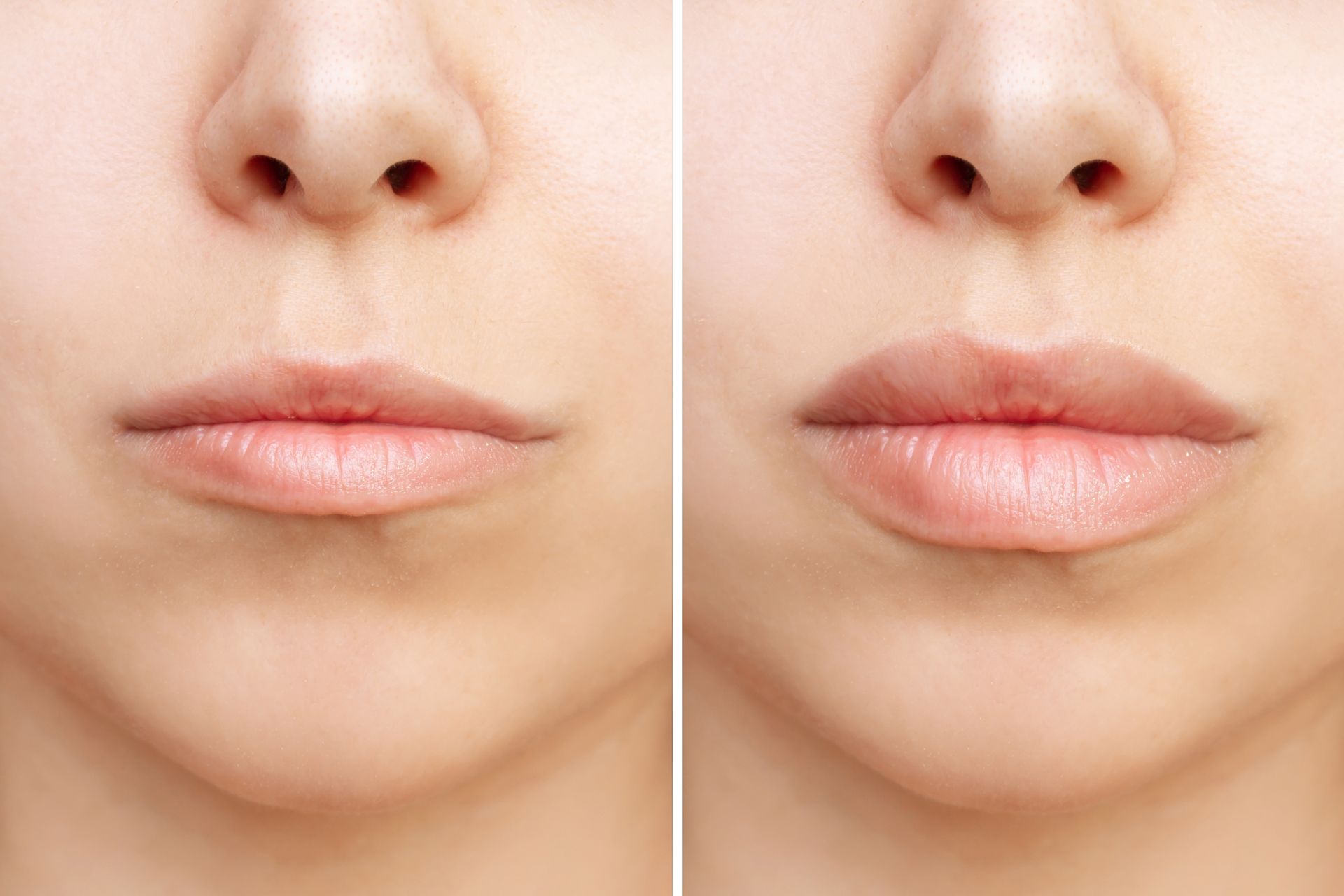 A before and after photo of a woman 's lips.