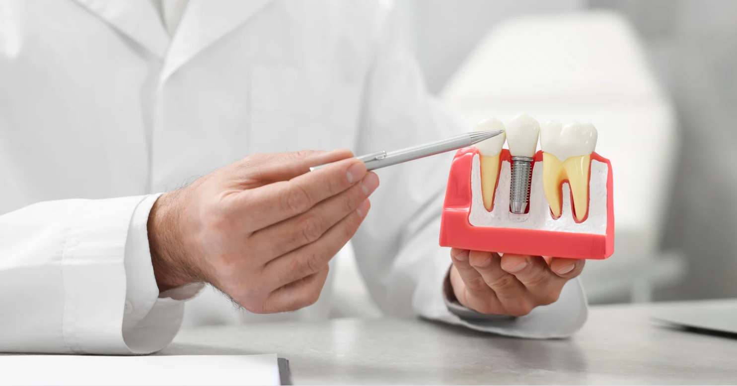 How does the cost of dental implants compare to other options