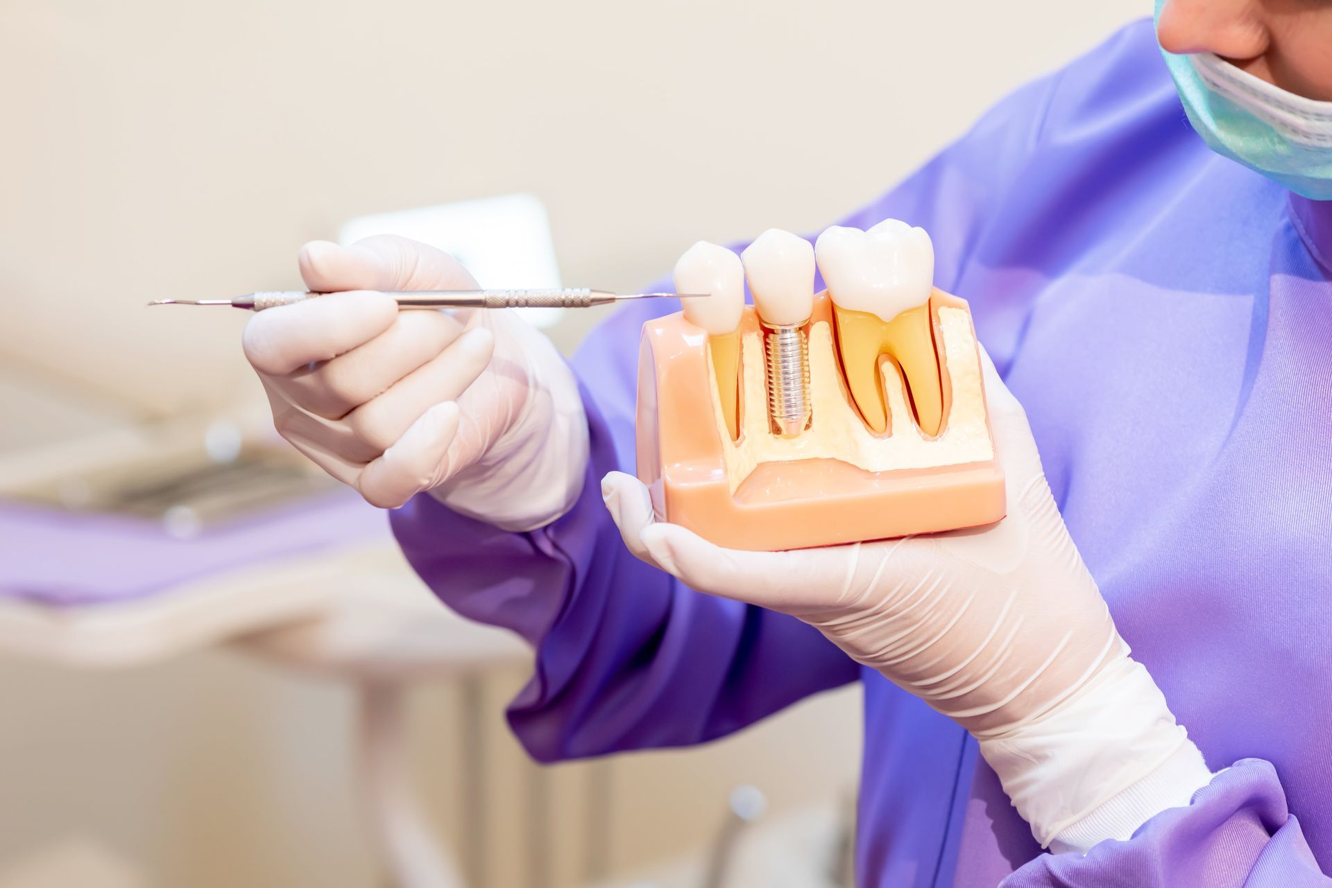 A Guide to Mastering Dental Implant Aftercare