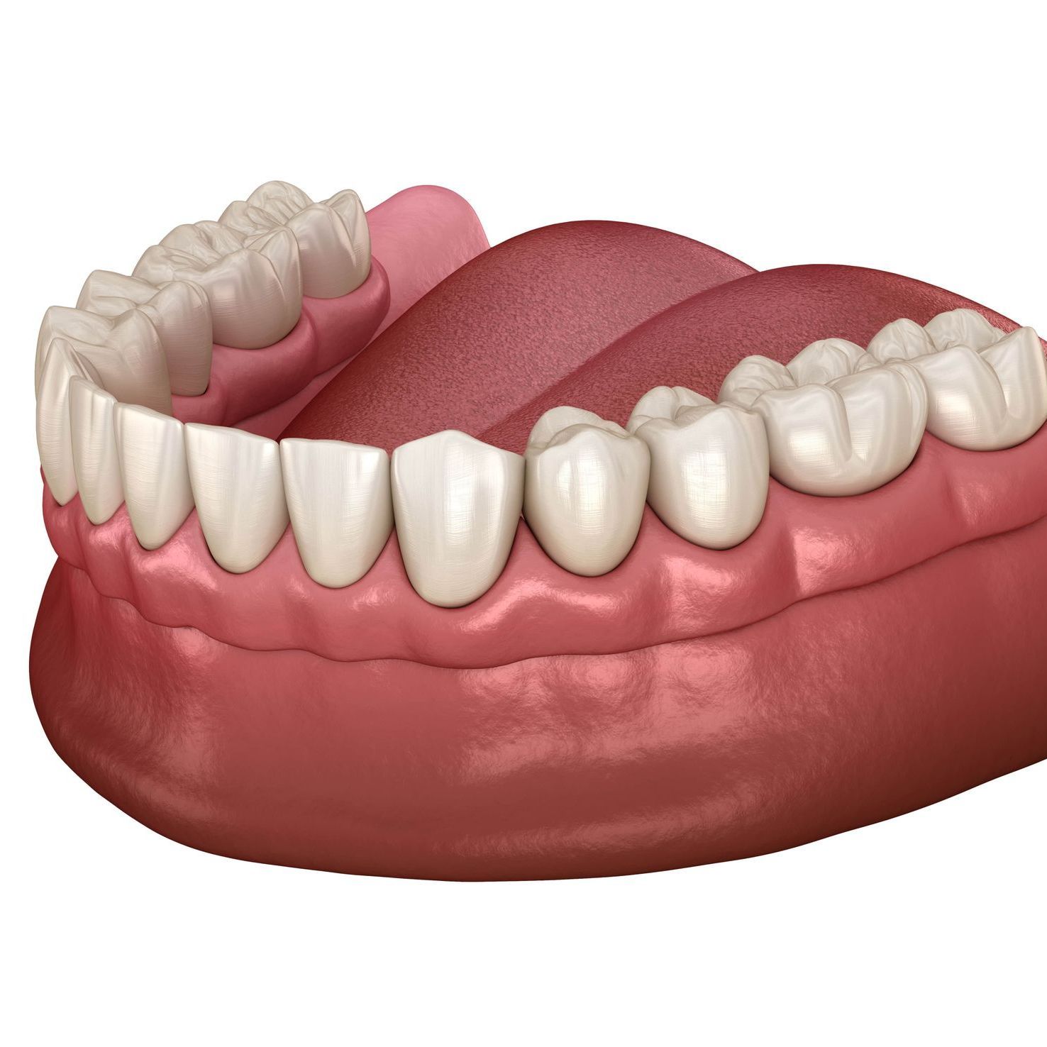 A computer generated image of a complete denture on the bottom jaw