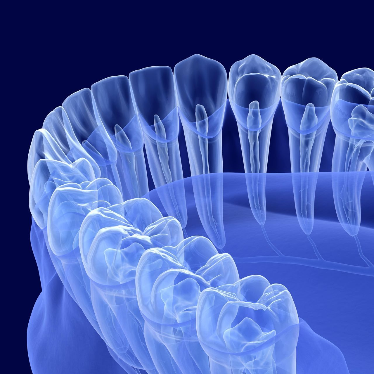 A computer generated image of a dental x-ray