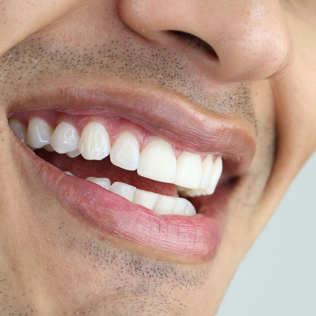 An up close shot of a man's smile with straight, white teeth
