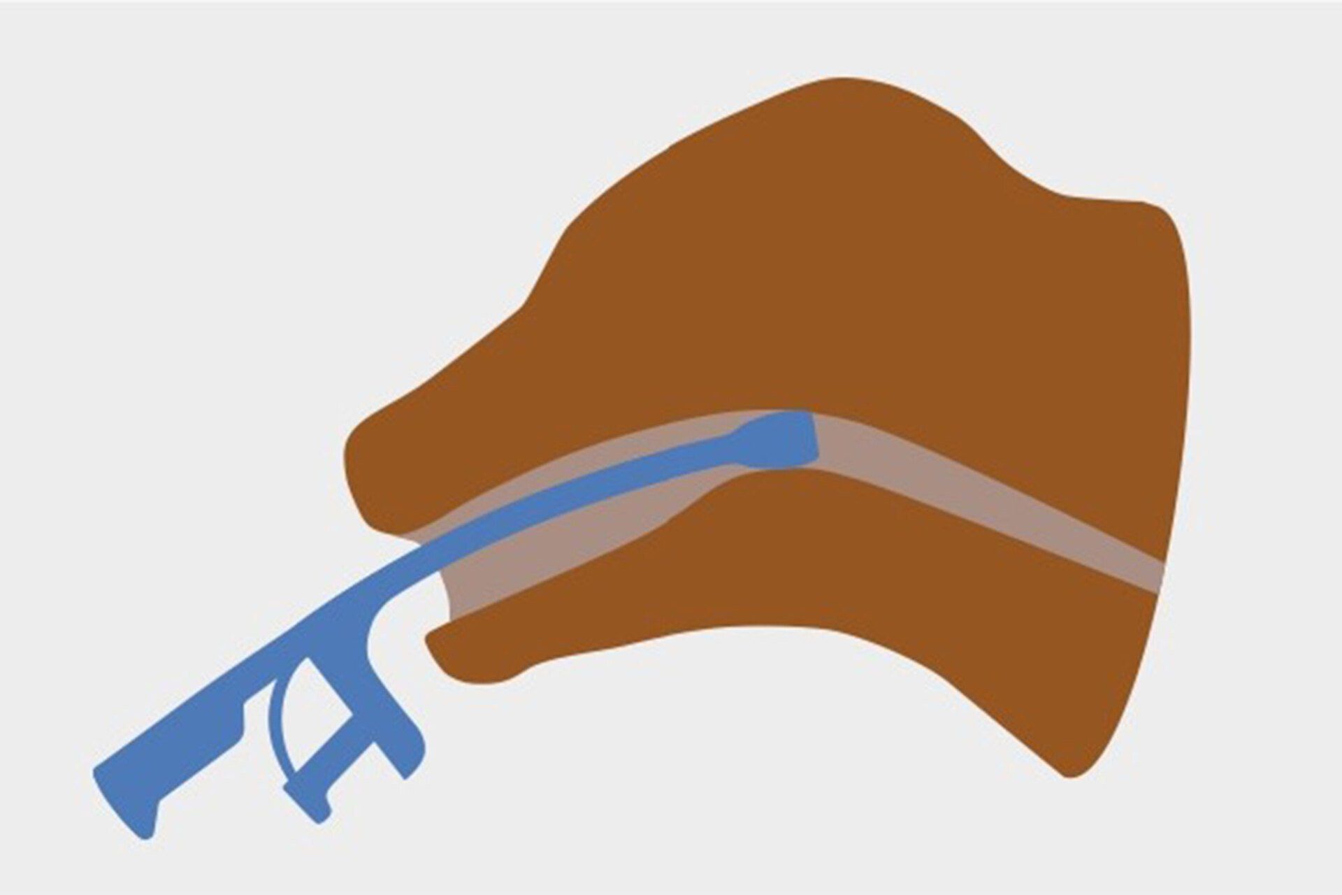 Querschnitt: Pillen-Eingeber bei einem Kalb