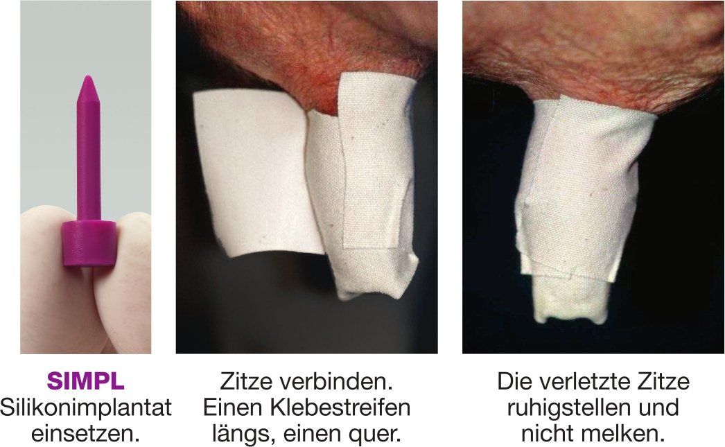 SMPL Silikonimplantat, Zitzenverletzung Kuh, Euterentzündung